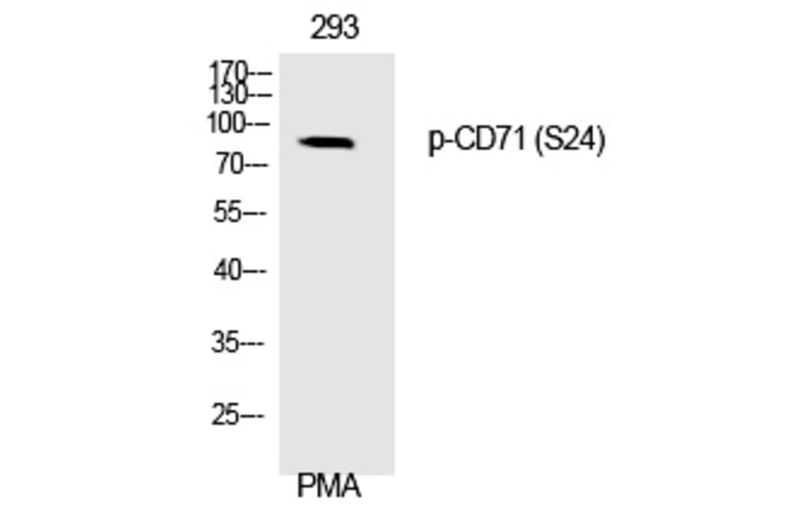 Western blot - CD71 (Phospho-Ser24) Polyclonal Antibody from Signalway Antibody (12325) - Antibodies.com