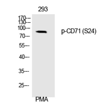 Western blot - CD71 (Phospho-Ser24) Polyclonal Antibody from Signalway Antibody (12325) - Antibodies.com