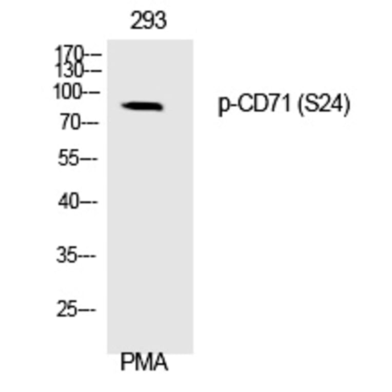 Western blot - CD71 (Phospho-Ser24) Polyclonal Antibody from Signalway Antibody (12325) - Antibodies.com