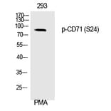 Western blot - CD71 (Phospho-Ser24) Polyclonal Antibody from Signalway Antibody (12325) - Antibodies.com