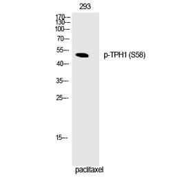 Western blot - TPH1 (Phospho-Ser58) Polyclonal Antibody from Signalway Antibody (12328) - Antibodies.com