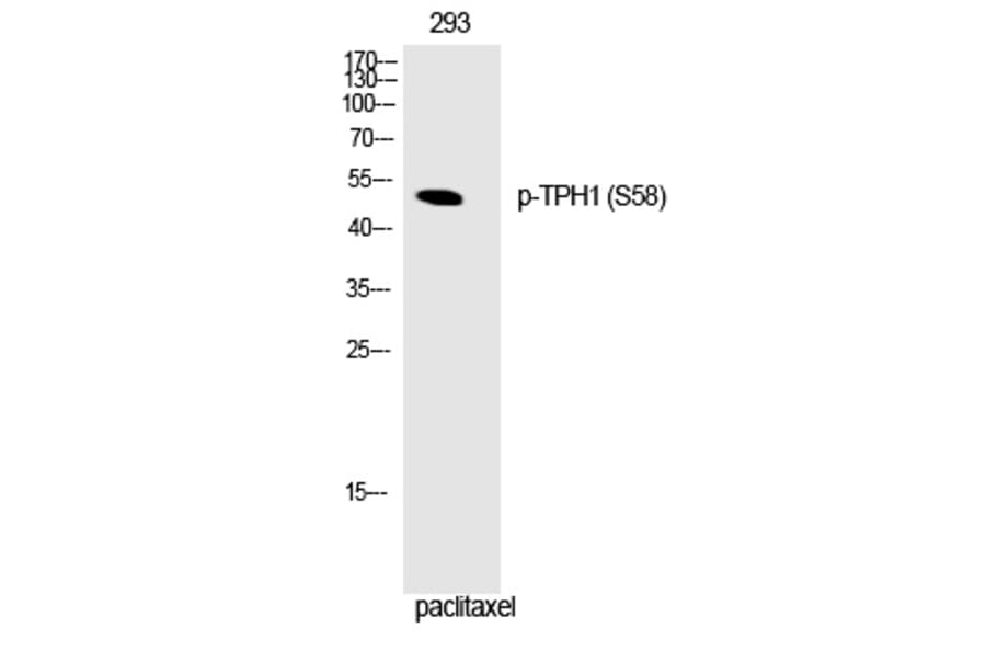 Western blot - TPH1 (Phospho-Ser58) Polyclonal Antibody from Signalway Antibody (12328) - Antibodies.com