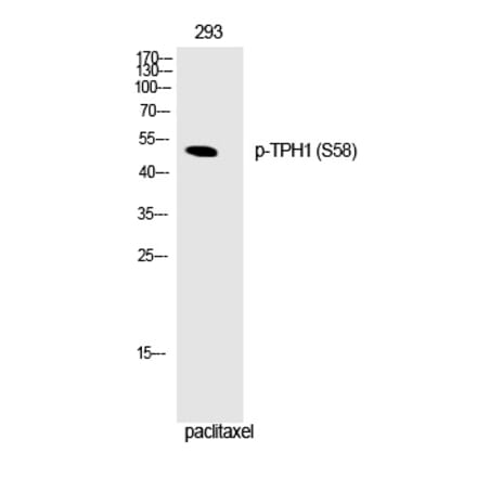 Western blot - TPH1 (Phospho-Ser58) Polyclonal Antibody from Signalway Antibody (12328) - Antibodies.com