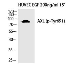 Western blot - Axl (Phospho-Tyr691) Polyclonal Antibody from Signalway Antibody (12335) - Antibodies.com