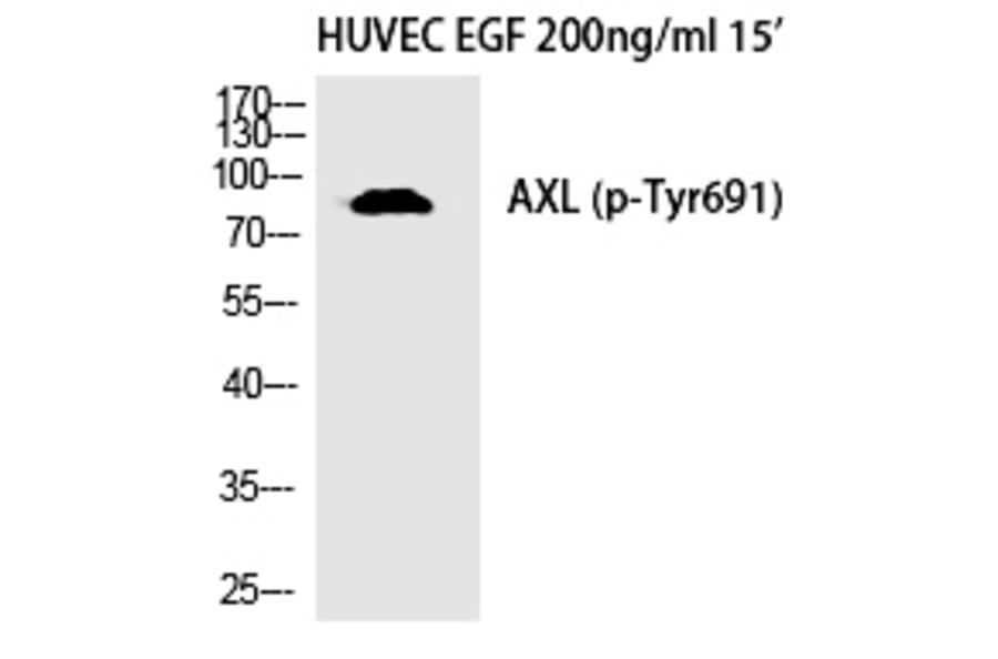 Western blot - Axl (Phospho-Tyr691) Polyclonal Antibody from Signalway Antibody (12335) - Antibodies.com