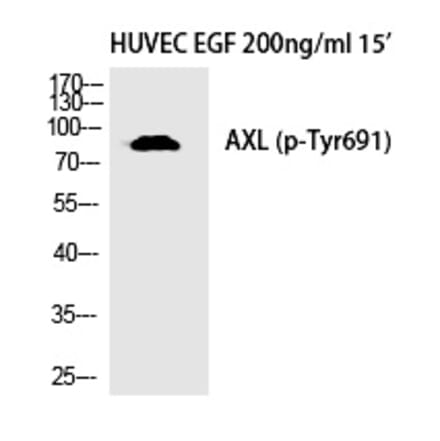 Western blot - Axl (Phospho-Tyr691) Polyclonal Antibody from Signalway Antibody (12335) - Antibodies.com