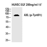 Western blot - Axl (Phospho-Tyr691) Polyclonal Antibody from Signalway Antibody (12335) - Antibodies.com