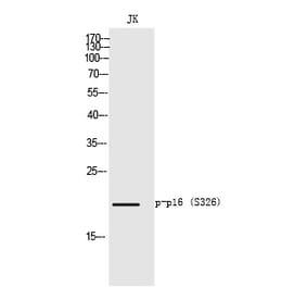 Western blot - p16 (Phospho-Ser326) Polyclonal Antibody from Signalway Antibody (12343) - Antibodies.com
