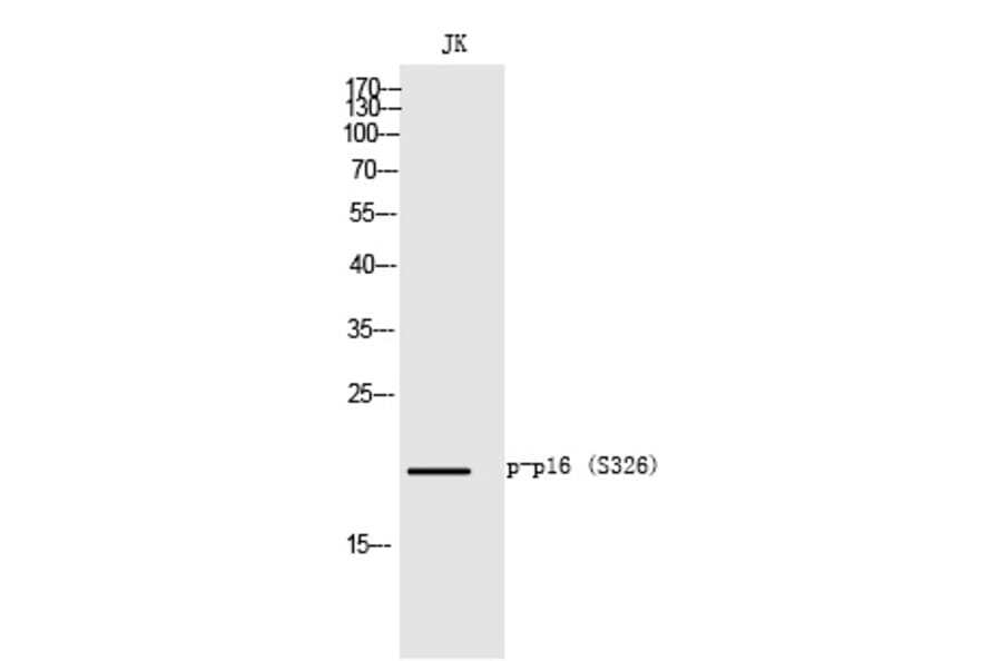 Western blot - p16 (Phospho-Ser326) Polyclonal Antibody from Signalway Antibody (12343) - Antibodies.com