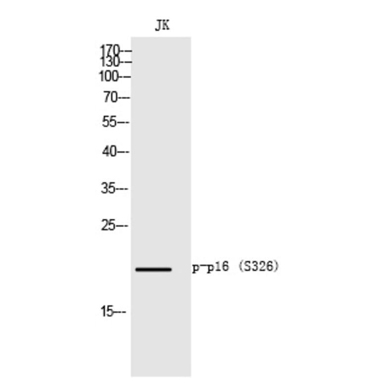 Western blot - p16 (Phospho-Ser326) Polyclonal Antibody from Signalway Antibody (12343) - Antibodies.com