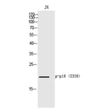 Western blot - p16 (Phospho-Ser326) Polyclonal Antibody from Signalway Antibody (12343) - Antibodies.com