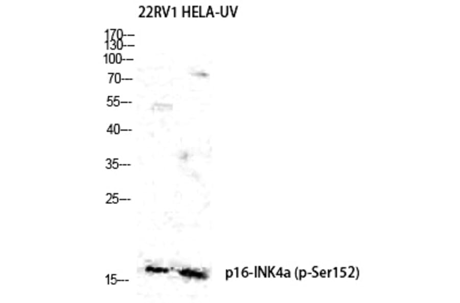 Western blot - p16 (Phospho-Ser326) Polyclonal Antibody from Signalway Antibody (12343) - Antibodies.com