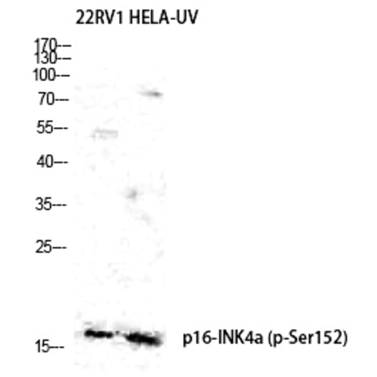 Western blot - p16 (Phospho-Ser326) Polyclonal Antibody from Signalway Antibody (12343) - Antibodies.com