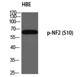 Western blot - NF2 (Phospho-Ser10) Polyclonal Antibody from Signalway Antibody (12334) - Antibodies.com