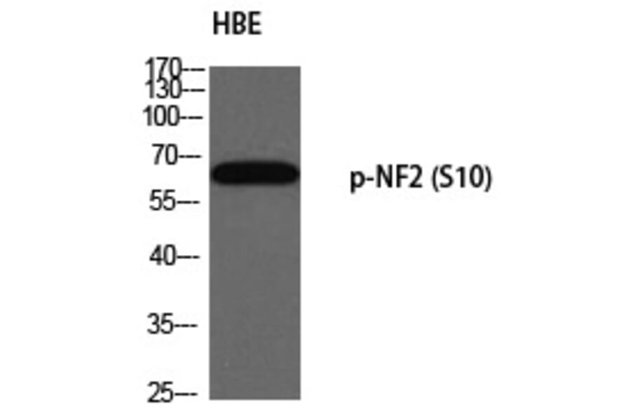 Western blot - NF2 (Phospho-Ser10) Polyclonal Antibody from Signalway Antibody (12334) - Antibodies.com