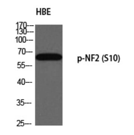 Western blot - NF2 (Phospho-Ser10) Polyclonal Antibody from Signalway Antibody (12334) - Antibodies.com
