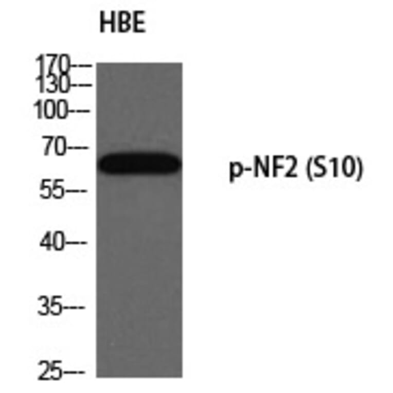 Western blot - NF2 (Phospho-Ser10) Polyclonal Antibody from Signalway Antibody (12334) - Antibodies.com