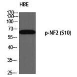 Western blot - NF2 (Phospho-Ser10) Polyclonal Antibody from Signalway Antibody (12334) - Antibodies.com
