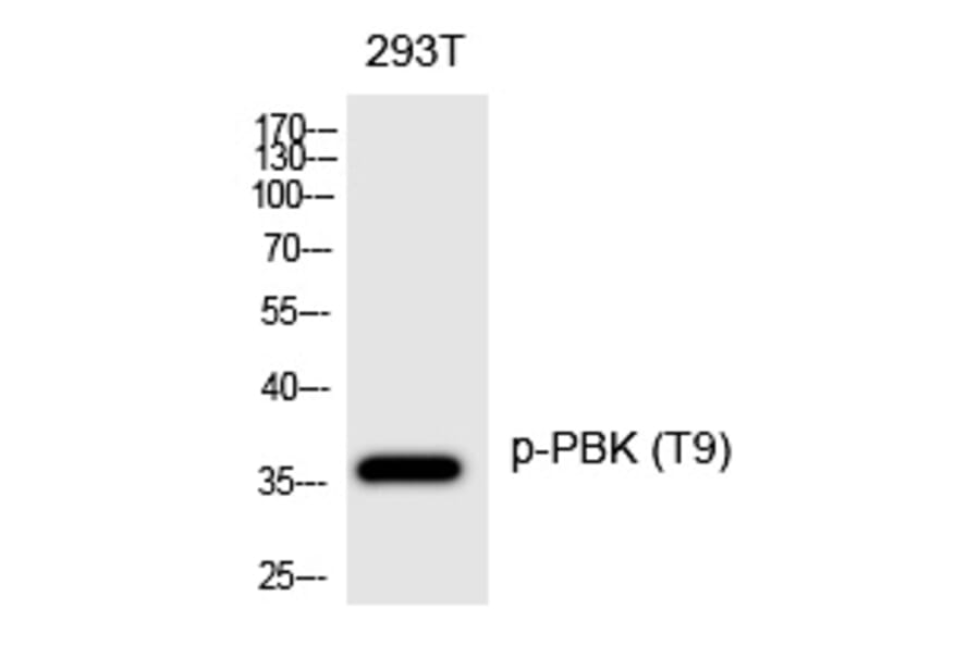 Western blot - PBK (Phospho-Thr9) Polyclonal Antibody from Signalway Antibody (12233) - Antibodies.com
