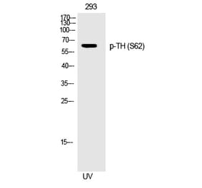 Western blot - TH (Phospho-Ser62) Polyclonal Antibody from Signalway Antibody (12282) - Antibodies.com