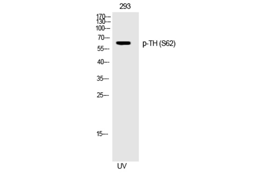 Western blot - TH (Phospho-Ser62) Polyclonal Antibody from Signalway Antibody (12282) - Antibodies.com