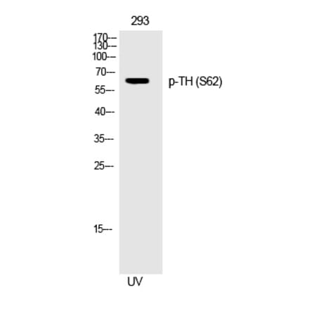 Western blot - TH (Phospho-Ser62) Polyclonal Antibody from Signalway Antibody (12282) - Antibodies.com