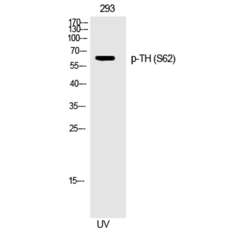 Western blot - TH (Phospho-Ser62) Polyclonal Antibody from Signalway Antibody (12282) - Antibodies.com