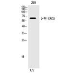 Western blot - TH (Phospho-Ser62) Polyclonal Antibody from Signalway Antibody (12282) - Antibodies.com
