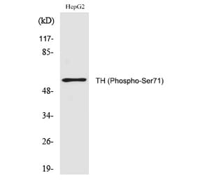 Western blot - TH (Phospho-Ser71) Polyclonal Antibody from Signalway Antibody (12283) - Antibodies.com