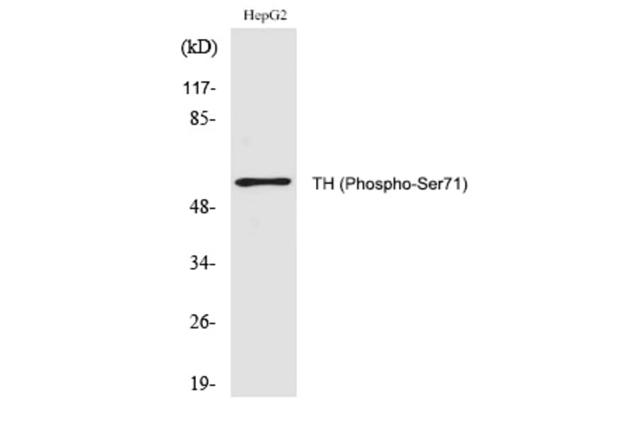 Western blot - TH (Phospho-Ser71) Polyclonal Antibody from Signalway Antibody (12283) - Antibodies.com
