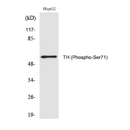 Western blot - TH (Phospho-Ser71) Polyclonal Antibody from Signalway Antibody (12283) - Antibodies.com