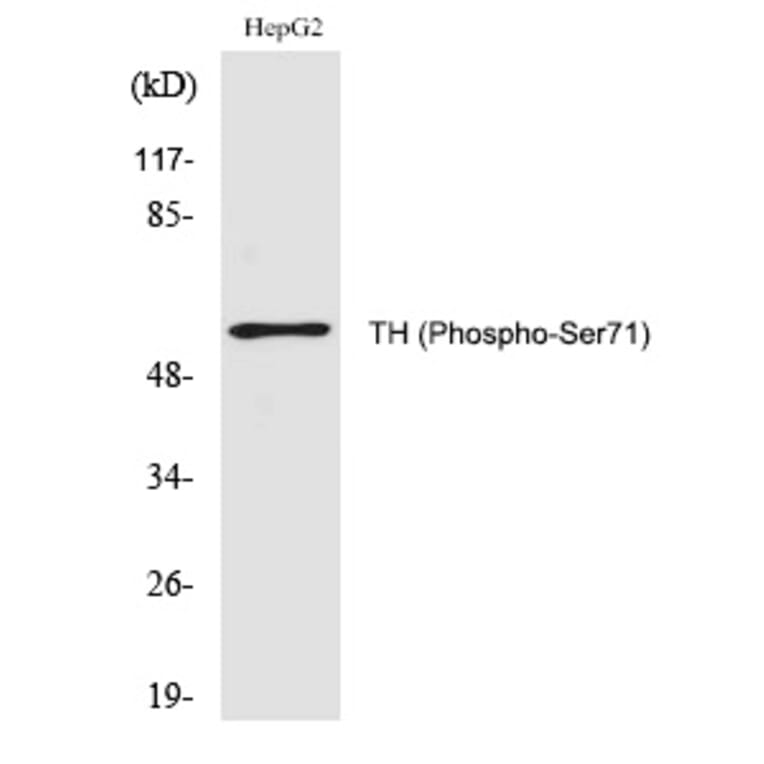 Western blot - TH (Phospho-Ser71) Polyclonal Antibody from Signalway Antibody (12283) - Antibodies.com