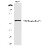 Western blot - TH (Phospho-Ser71) Polyclonal Antibody from Signalway Antibody (12283) - Antibodies.com