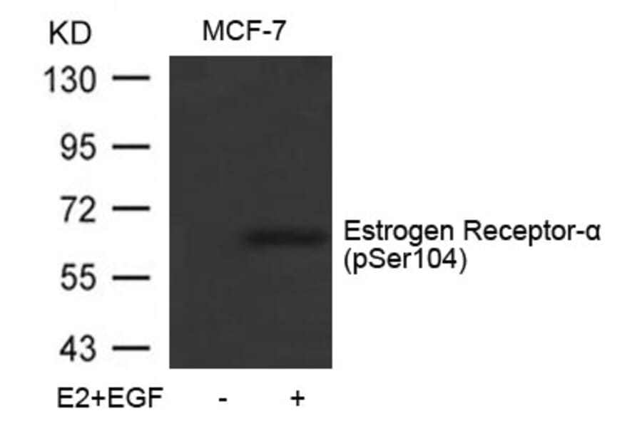 Western blot - Estrogen Receptor-a (Phospho-Ser104) Antibody from Signalway Antibody (11070) - Antibodies.com