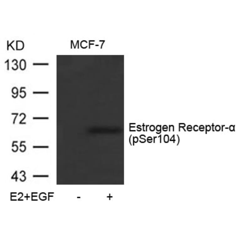 Western blot - Estrogen Receptor-a (Phospho-Ser104) Antibody from Signalway Antibody (11070) - Antibodies.com