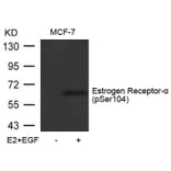 Western blot - Estrogen Receptor-a (Phospho-Ser104) Antibody from Signalway Antibody (11070) - Antibodies.com