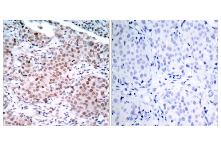 Immunohistochemistry - Estrogen Receptor-a (Phospho-Ser104) Antibody from Signalway Antibody - Antibodies.com
