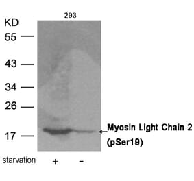 Western blot - Myosin Light Chain 2 (Phospho-Ser19) Antibody from Signalway Antibody (11114) - Antibodies.com