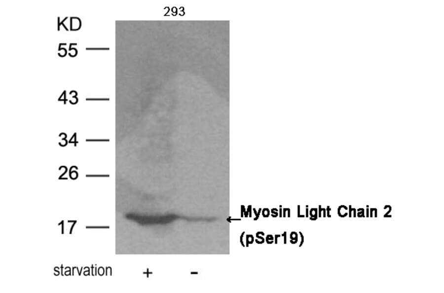 Western blot - Myosin Light Chain 2 (Phospho-Ser19) Antibody from Signalway Antibody (11114) - Antibodies.com