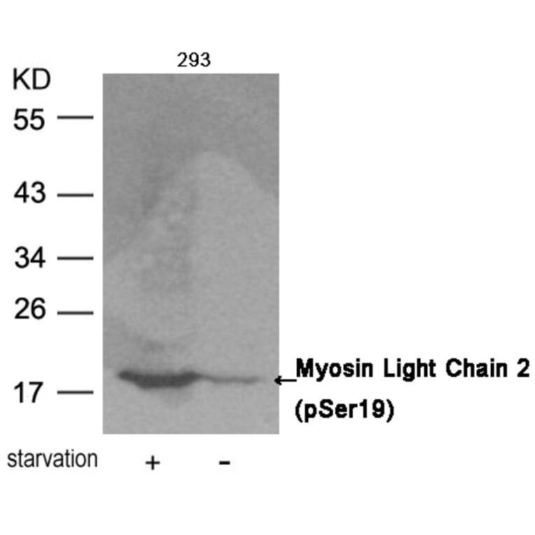 Western blot - Myosin Light Chain 2 (Phospho-Ser19) Antibody from Signalway Antibody (11114) - Antibodies.com