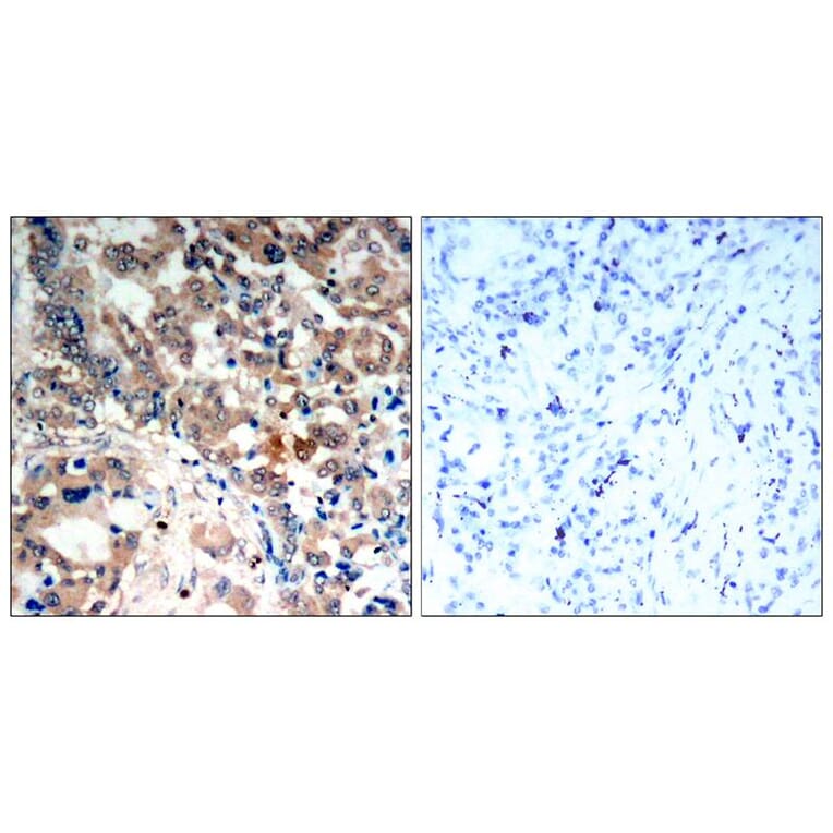 Immunohistochemistry - AMPKα1/AMPKα2 (Phospho-Thr183/Thr172) Antibody from Signalway Antibody - Antibodies.com