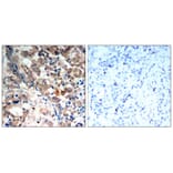 Immunohistochemistry - AMPKα1/AMPKα2 (Phospho-Thr183/Thr172) Antibody from Signalway Antibody - Antibodies.com