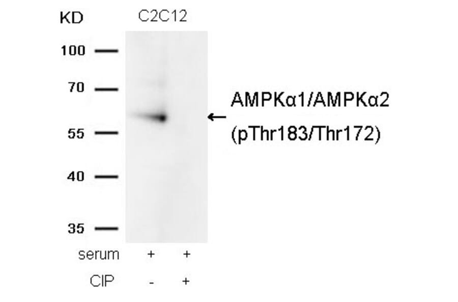 Western blot - AMPKα1/AMPKα2 (Phospho-Thr183/Thr172) Antibody from Signalway Antibody (11183) - Antibodies.com