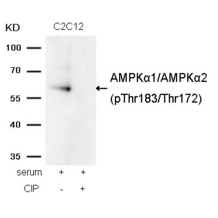 Western blot - AMPKα1/AMPKα2 (Phospho-Thr183/Thr172) Antibody from Signalway Antibody (11183) - Antibodies.com