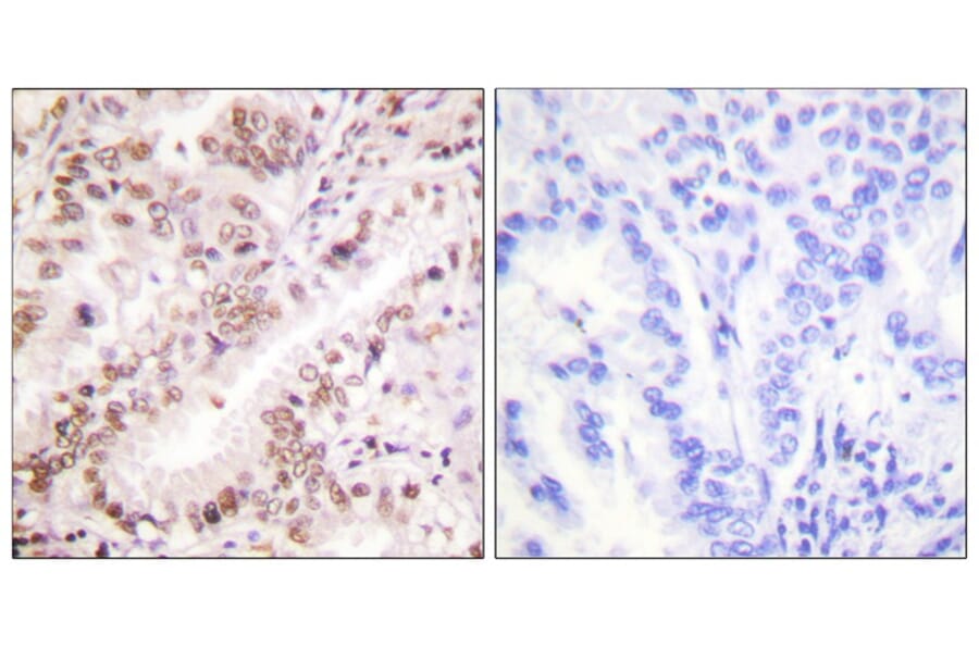 Immunohistochemistry - Estrogen Receptor-α (Phospho-Tyr537) Antibody from Signalway Antibody (11657)