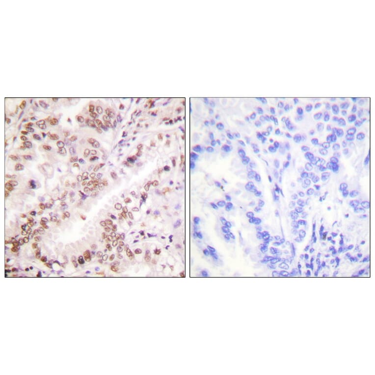 Immunohistochemistry - Estrogen Receptor-α (Phospho-Tyr537) Antibody from Signalway Antibody (11657)