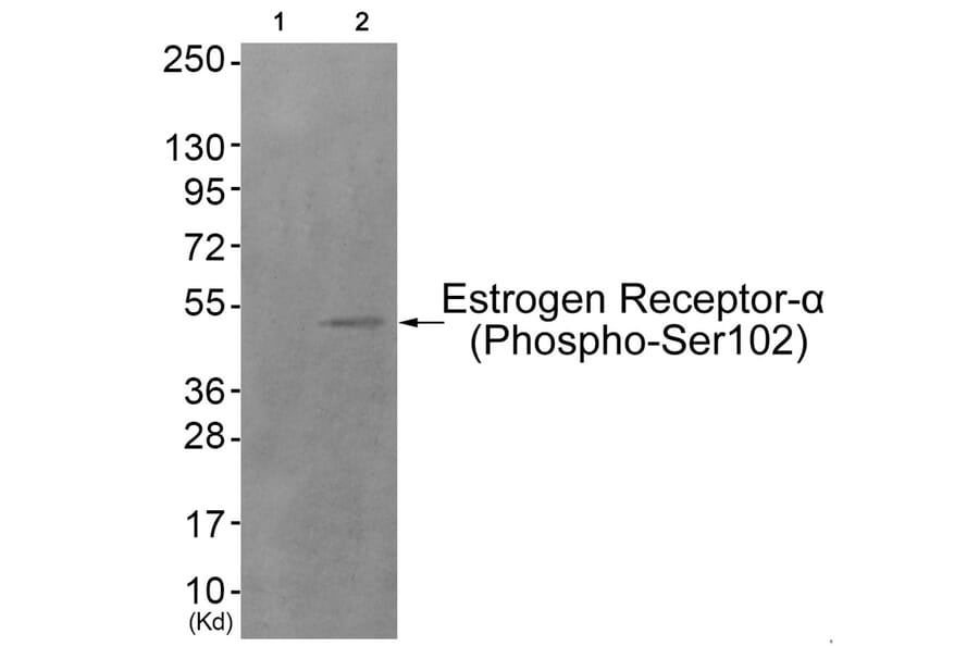 Western blot - Estrogen Receptor-α (Phospho-Ser102) Antibody from Signalway Antibody (11801) - Antibodies.com