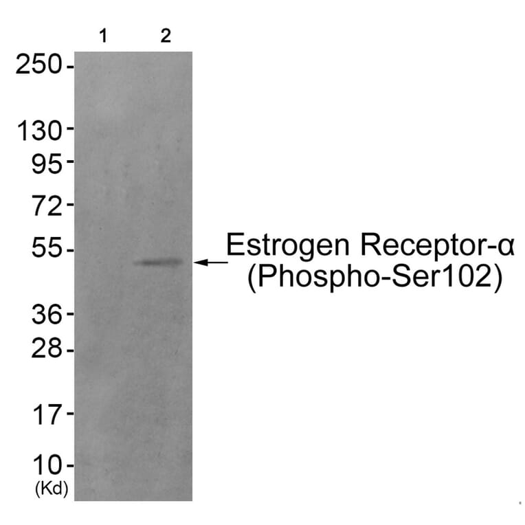 Western blot - Estrogen Receptor-α (Phospho-Ser102) Antibody from Signalway Antibody (11801) - Antibodies.com
