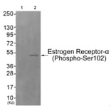 Western blot - Estrogen Receptor-α (Phospho-Ser102) Antibody from Signalway Antibody (11801) - Antibodies.com