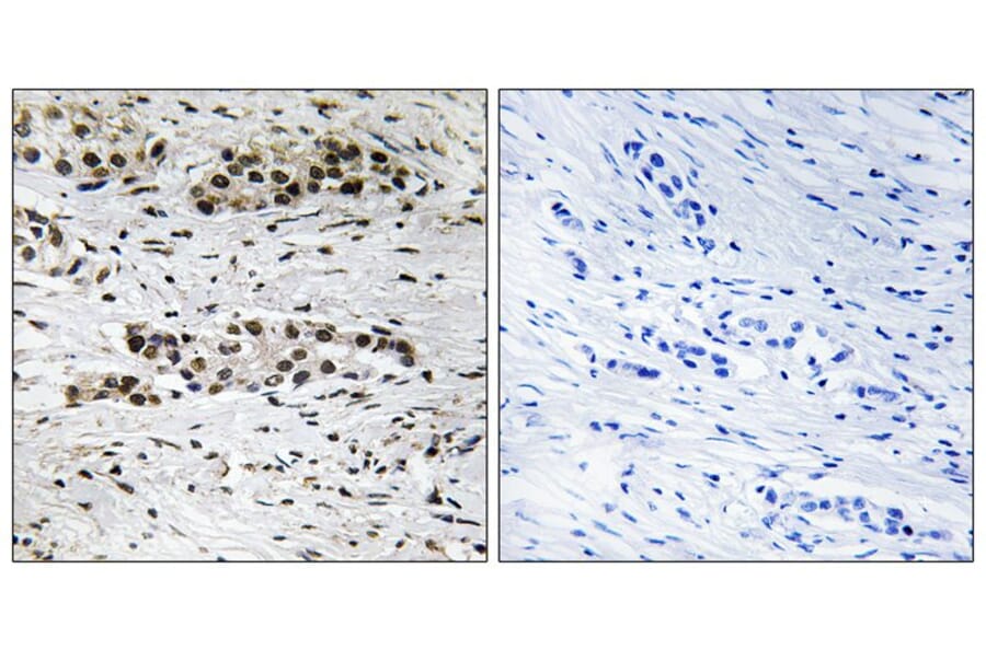 Immunohistochemistry - Estrogen Receptor-α (Phospho-Ser102) Antibody from Signalway Antibody (11801)